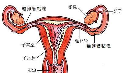 输卵管黏连做第三代试管婴儿成功率多少