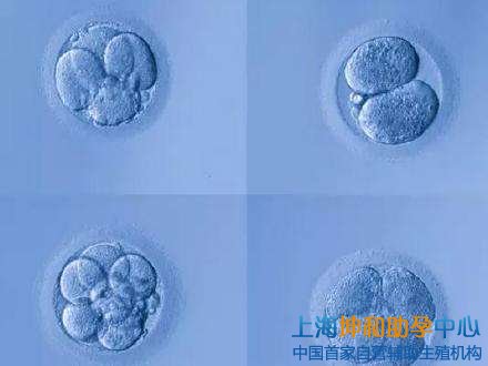 国内供卵试管婴儿医院;上海试管婴儿胚胎分级标准